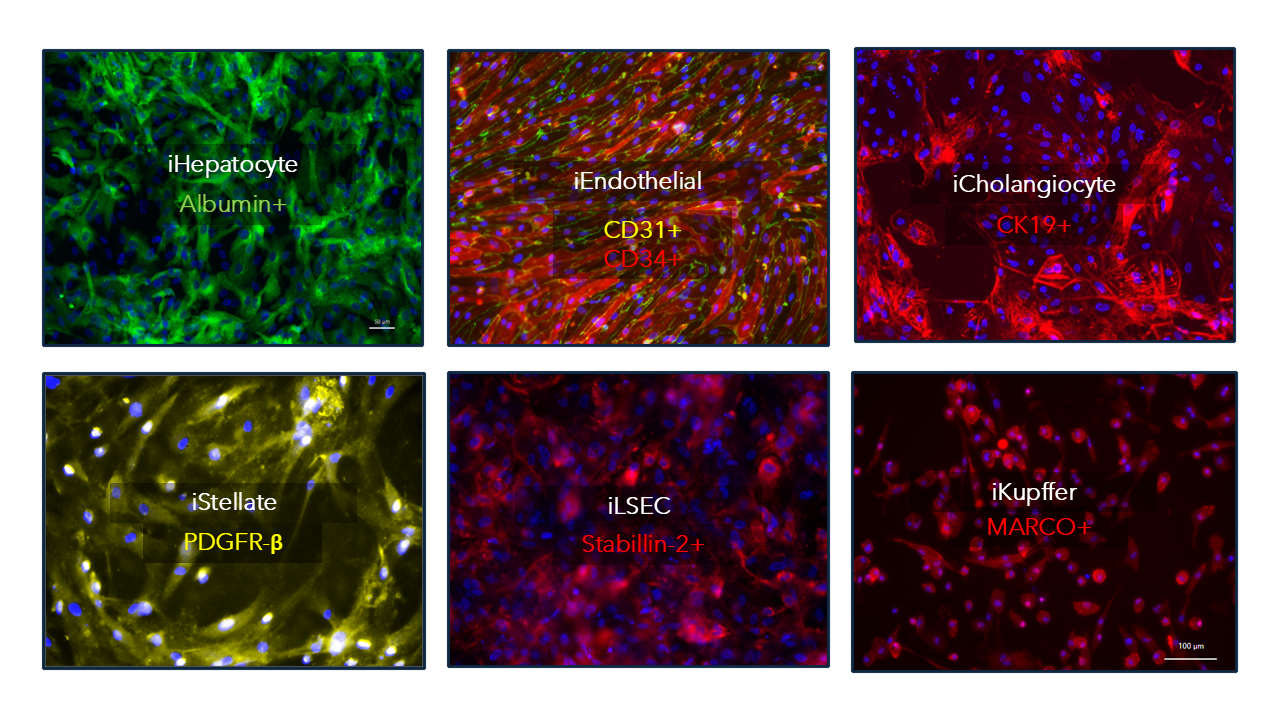 Fluorescent microscopy panel showing iHepatocyte Albumin positive, iEndothelial CD31 and CD34 positive, iCholangiocyte CK19 positive, iStellate PDGFR beta, iLSEC Stabilin-2 positive, and iKupffer MARCO positive cells.